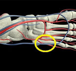 NBA伤病频频为哪般
