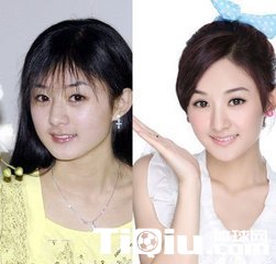 赵丽颖张天爱教你跑步减肥变女神